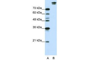 WB Suggested Anti-SF3B1 Antibody Titration:  0. (SF3B1 Antikörper  (N-Term))