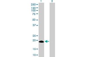Western Blot analysis of IFNA17 expression in transfected 293T cell line by IFNA17 MaxPab polyclonal antibody. (IFNA17 Antikörper  (AA 1-189))