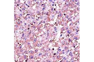 Immunohistochemistry (IHC) image for anti-Insulin-Like Growth Factor 1 (IGF1) (AA 115-144) antibody (ABIN3031342)