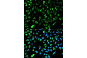 Immunofluorescence analysis of A549 cell using NME1 antibody. (NME1 Antikörper  (C-Term))