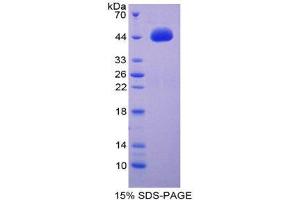 SDS-PAGE (SDS) image for Brain-Derived Neurotrophic Factor (BDNF) (AA 139-249) protein (His tag,GST tag) (ABIN2122504)