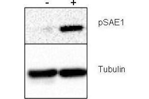 Western blot using  Rabbit anti-SAE1 pS185 antibody shows detection of phosphorylated SAE1.