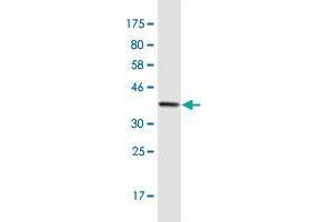 Western Blot detection against Immunogen (36. (DICER1 Antikörper  (AA 1813-1912))