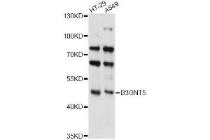 Western blot analysis of extracts of various cell lines, using B3GNT5 antibody (ABIN6293241) at 1:3000 dilution. (B3GNT5 Antikörper)