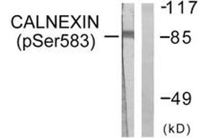 Western blot analysis of extracts from HeLa cells treated with EGF 200ng/ml 30', using Calnexin (Phospho-Ser583) Antibody. (Calnexin Antikörper  (pSer583))
