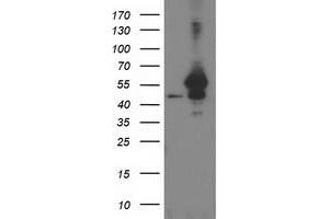 Western Blotting (WB) image for anti-ADP-Ribosylation Factor GTPase Activating Protein 1 (ARFGAP1) antibody (ABIN1496682) (ARFGAP1 Antikörper)