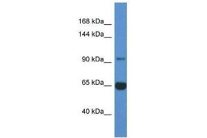 Western Blot showing Man2a2 antibody used at a concentration of 1. (MAN2A2 Antikörper  (N-Term))