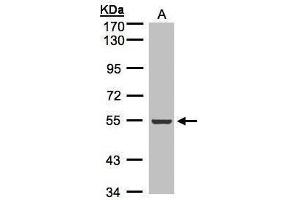 WB Image Sample(30 μg of whole cell lysate) A:A431, 7.