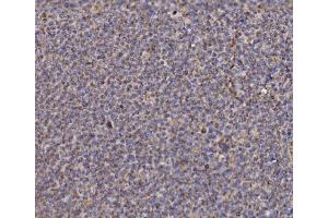 IHC analysis of NDUFAF1 using anti-NDUFAF1 antibody (ABIN7602459).