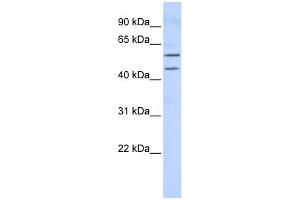 WB Suggested Anti-TBX22 Antibody Titration:  0. (T-Box 22 Antikörper  (Middle Region))