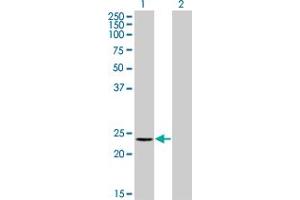 Western Blot analysis of RCV1 expression in transfected 293T cell line by RCV1 monoclonal antibody (M11), clone 2B3. (Recoverin Antikörper  (AA 101-199))