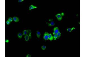 Immunofluorescence staining of MCF-7 cells with ABIN7151929 at 1:133, counter-stained with DAPI. (EMP2 Antikörper  (AA 22-66))