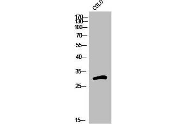 OR5H15 Antikörper  (C-Term)