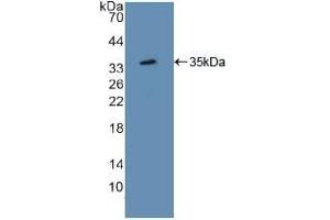 Detection of Recombinant ATF1, Mouse using Polyclonal Antibody to Activating Transcription Factor 1 (ATF1) (AFT1 Antikörper  (AA 3-245))