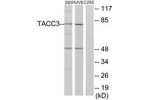 Western blot analysis of extracts from 293/HuvEc cells, using TACC3 Antibody. (TACC3 Antikörper  (AA 789-838))