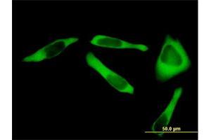 Immunofluorescence of purified MaxPab antibody to RARS on HeLa cell. (RARS Antikörper  (AA 1-660))