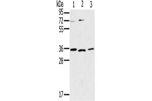 Western Blotting (WB) image for anti-Interleukin 22 Receptor, alpha 2 (IL22RA2) antibody (ABIN2430301) (IL22RA2 Antikörper)