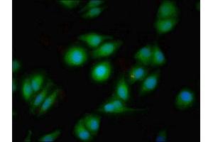 Immunofluorescent analysis of A549 cells using ABIN7149466 at dilution of 1:100 and Alexa Fluor 488-congugated AffiniPure Goat Anti-Rabbit IgG(H+L) (Dopamine Receptor d1 Antikörper  (AA 338-446))