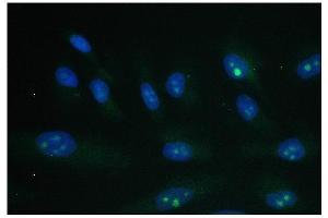 IF analysis of PARN using anti-PARN antibody (ABIN6719422). (PARN Antikörper  (AA 1-301))