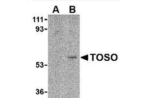 Image no. 1 for anti-Fas Apoptotic Inhibitory Molecule 3 (FAIM3) (C-Term) antibody (ABIN318759)