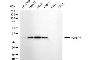 Western blotting analysis using IGFBP7 antibody (ABIN7799057). (Rekombinanter IGFBP7 Antikörper)