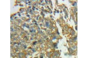 IHC-P analysis of Ovary tissue, with DAB staining. (SIRPG Antikörper  (AA 111-372))