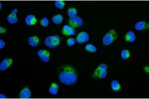 IF analysis of TIMM29 using anti-TIMM29 antibody (ABIN7601495). (TIMM29 Antikörper  (AA 37-260))