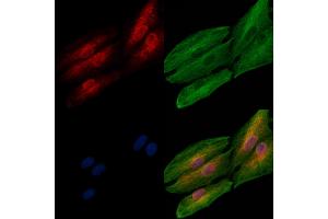 ABIN6262593 and ABIN6278013 staining  cells by IF/ICC.