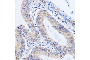 Immunohistochemistry (IHC) image for anti-RNA Binding Motif Protein 39 (RBM39) (C-Term) antibody (ABIN7270085)