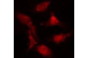 ABIN6274986 staining  Hela cells by IF/ICC.
