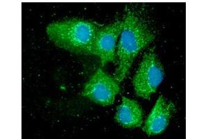 ICC/IF analysis of PDIA3 in Hep3B cells line, stained with DAPI (Blue) for nucleus staining and monoclonal anti-human PDIA3 antibody (1:100) with goat anti-mouse IgG-Alexa fluor 488 conjugate (Green).