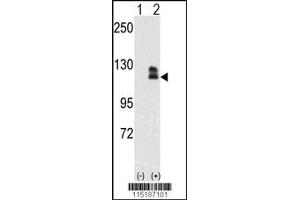 Western blot analysis of EphB2 using rabbit polyclonal EphB2 Antibody. (EPH Receptor B2 Antikörper)
