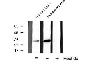 Western blot analysis of CDK5 phosphorylation expression in mouse brain and mouse muscle cell lysates,The lane on the right is treated with the antigen-specific peptide. (CDK5 Antikörper  (pTyr15))