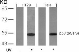Image no. 2 for anti-Tumor Protein P53 (TP53) (pSer6) antibody (ABIN319211) (p53 Antikörper  (pSer6))