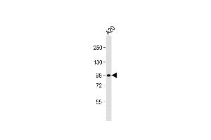 Western Blotting (WB) image for anti-Small Nuclear Ribonucleoprotein Polypeptide E (SNRPE) (AA 424-453) antibody (ABIN392249)