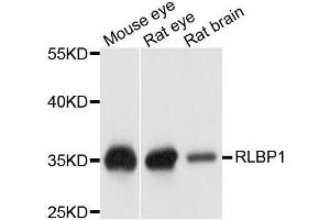 Western blot analysis of extracts of various cell lines, using RLBP1 antibody. (RLBP1 Antikörper  (AA 1-317))