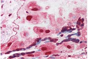 Human Placenta (formalin-fixed, paraffin-embedded) stained with ORAI3 antibody ABIN351441 at 3 ug/ml followed by biotinylated goat anti-rabbit IgG secondary antibody ABIN481713, alkaline phosphatase-streptavidin and chromogen. (ORAI3 Antikörper  (C-Term))