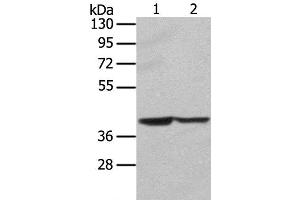 Western Blot analysis of Hela and hepg2 cell using STX16 Polyclonal Antibody at dilution of 1:400 (Syntaxin 16 Antikörper)