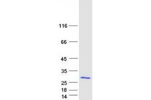 Western Blotting (WB) image for PYD and CARD Domain Containing (PYCARD) (Transcript Variant 2) protein (Myc-DYKDDDDK Tag) (ABIN2713166)