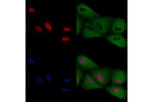 ABIN6259152 and ABIN6274301 staining  cells by IF/ICC. (PITX1 Antikörper  (Internal Region))