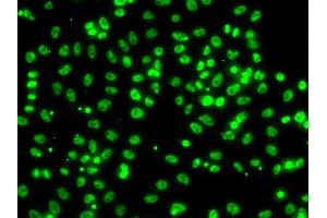 Immunofluorescence analysis of A549 cells using CSRNP1 antibody. (AXUD1 Antikörper)