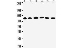 Anti-PC1/3 antibody, Western blotting Lane 1: Rat Liver Tissue Lysate Lane 2: Rat Thymus Tissue Lysate Lane 3: A549 Cell Lysate Lane 4: HELA Cell Lysate Lane 5: COLO320 Cell Lysate Lane 6: PANC Cell Lysate (PCSK1 Antikörper  (C-Term))