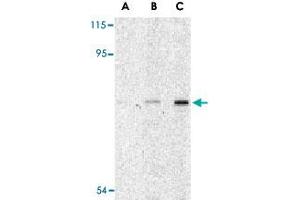 Western blot analysis of ATG7 in L1210 cell lysate with ATG7 polyclonal antibody  at (A) 1, (B) 2 and (C) 4 ug/mL . (ATG7 Antikörper  (N-Term))