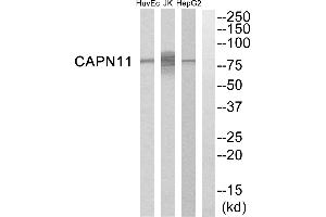 Western blot analysis of extracts from HepG2 cells, Jurkat cells and HuvEc cells, using CAPN11 antibody. (CAPN11 Antikörper)
