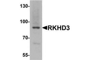 Western blot analysis of RKHD3 in mouse skeletal muscle tissue lysate with RKHD3 antibody at 1 ug/mL. (MEX3B Antikörper  (Middle Region))