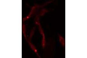 ABIN6275040 staining  NIH-3T3 cells by IF/ICC. (Superoxide dismutase copper chaperone Antikörper  (C-Term))
