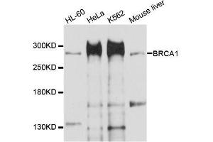 Western blot analysis of extracts of various cell lines, using BRCA1 antibody. (BRCA1 Antikörper  (AA 400-699))