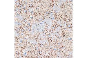 Immunohistochemistry of paraffin-embedded rat brain using GOT2 Rabbit mAb (ABIN7267427) at dilution of 1:100 (40x lens). (GOT2 Antikörper)