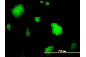 Image no. 4 for anti-Slingshot Homolog 3 (SSH3) (AA 293-392) antibody (ABIN599261) (SSH3 Antikörper  (AA 293-392))