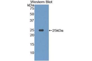 Western blot analysis of the recombinant protein. (TREM1 Antikörper  (AA 21-230))